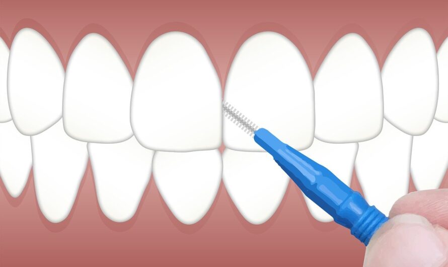 Zahnspangen: Möglichkeiten der Kieferorthopädie für ein schönes Lächeln